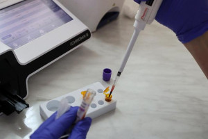 Анализ крови на 60 видов рака можно сдавать в Витебске с начала июня