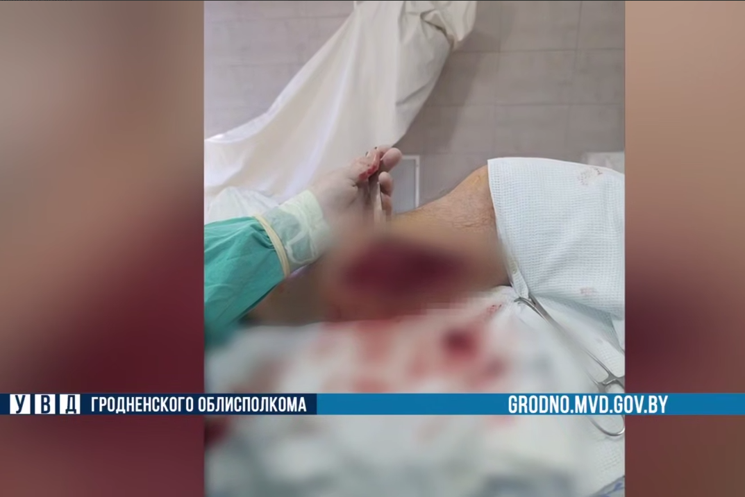 Житель Гродненщины получил огнестрельные ранения в Польше и госпитализирован в тяжелом состоянии